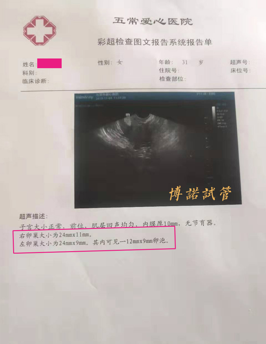德国代孕流程.jpg