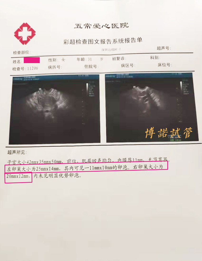 德国代孕妈妈.jpg