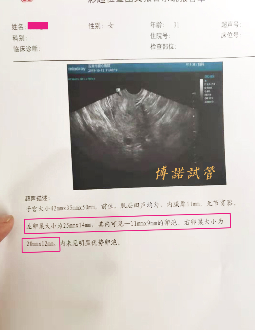 德国代孕中介.jpg