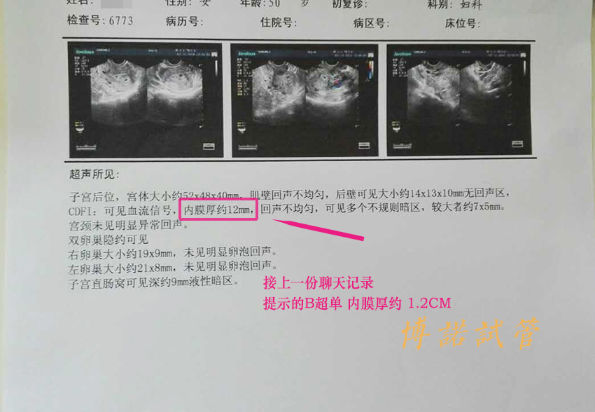 德国代孕价格.jpg
