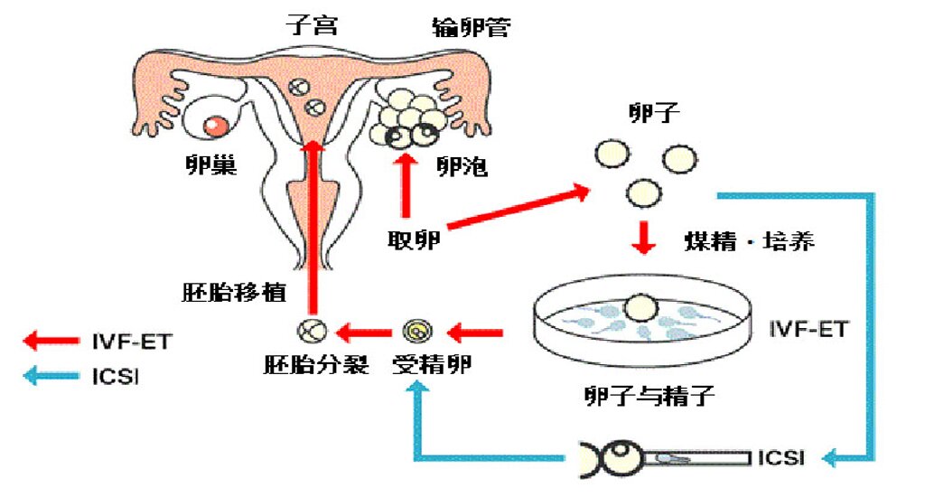 德国代孕机构：我的“幸孕”不是“奇迹”